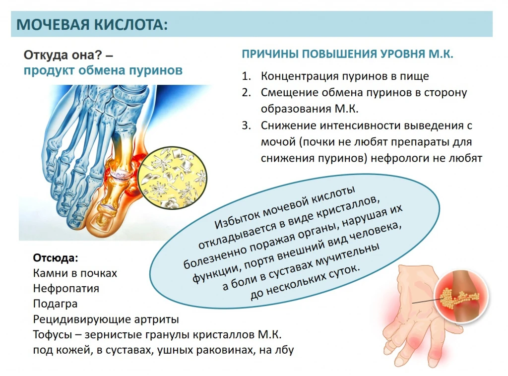 Квас повышает мочевую кислоту