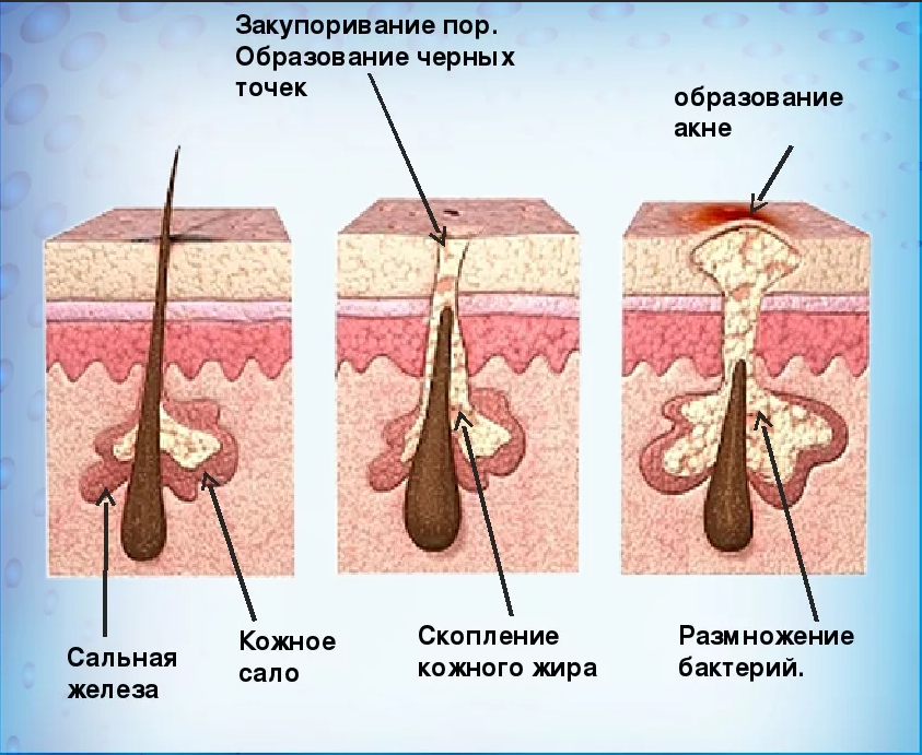 Инновации и результаты: Восстановление кожи с Fraxel