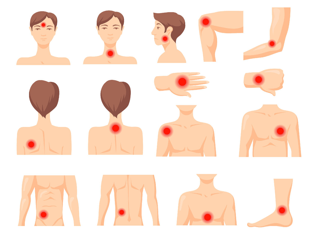 Триггерные точки <a href="https://ru.freepik.com/free-vector/focus-of-pain-set-parts-of-human-body-with-red-spot-ache-in-muscles-or-joints_13146298.htm#fromView=search&page=8&position=1&uuid=69246824-2d18-4bd0-8b16-39fb18dec5a4">Изображение от pch.vector</a> на Freepik