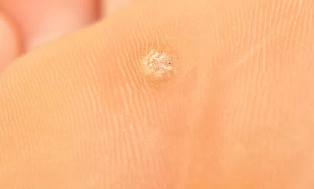 Речь вот о таком явлении