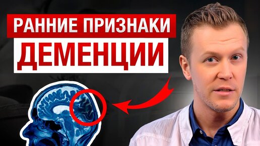 Download Video: СПАСИ РАЗУМ ПОКА НЕ ПОЗДНО! / Как ИЗБЕЖАТЬ деменции и ОСТАНОВИТЬ болезнь на ранних стадиях?