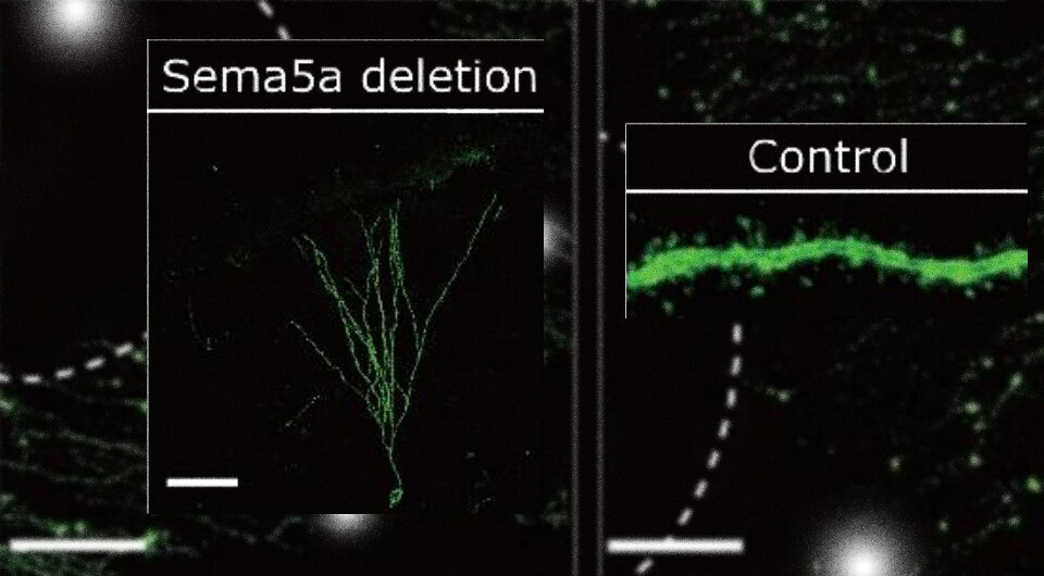   N + 1; Risako Fujikawa et al. / Molecular Psychiatry, 2024