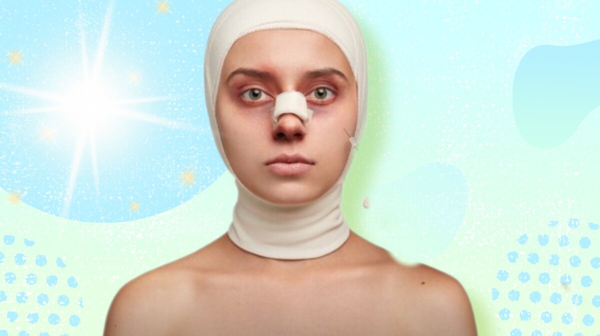 Cделал жене пластическую операцию без её согласия

