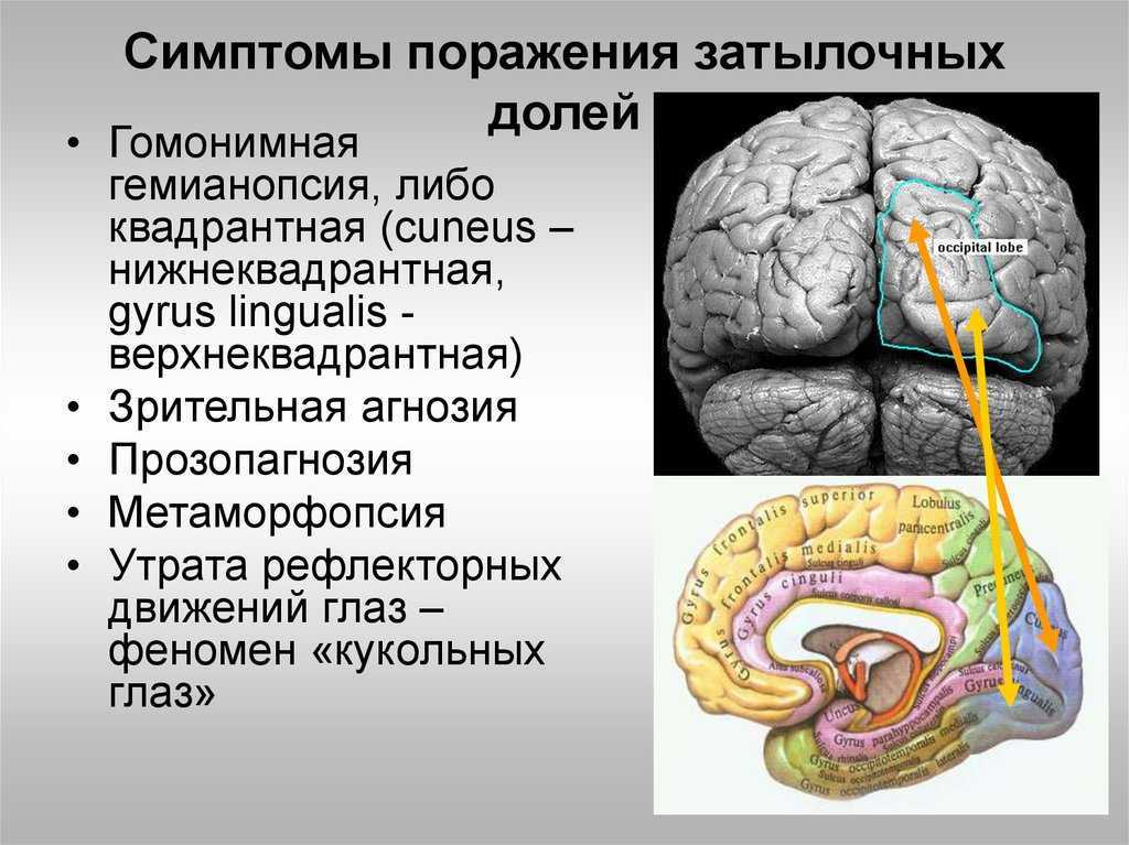 Головной мозг и его последствия. Синдром поражения затылочной доли мозга. Симптомы поражения теменной доли головного мозга. Поражение теменной доли коры головного мозга. Симптомы поражения теменной доли мозга.