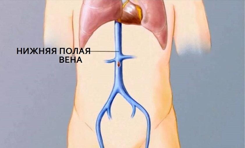 В нижнюю полую вену впадают венозные притоки от внутренних органов
