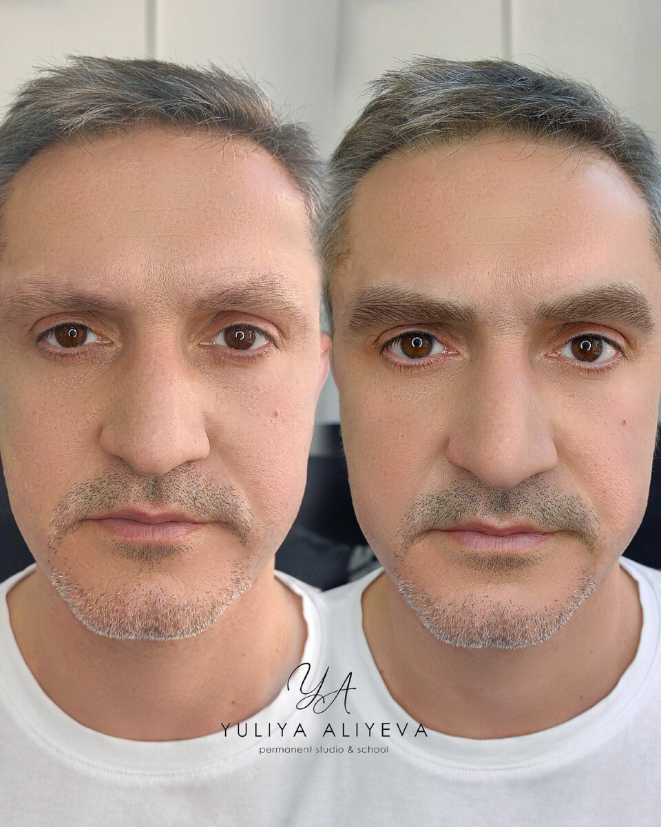На фото – перманентный макияж бровей в технике Realistic hairs, до и результат сразу после процедуры