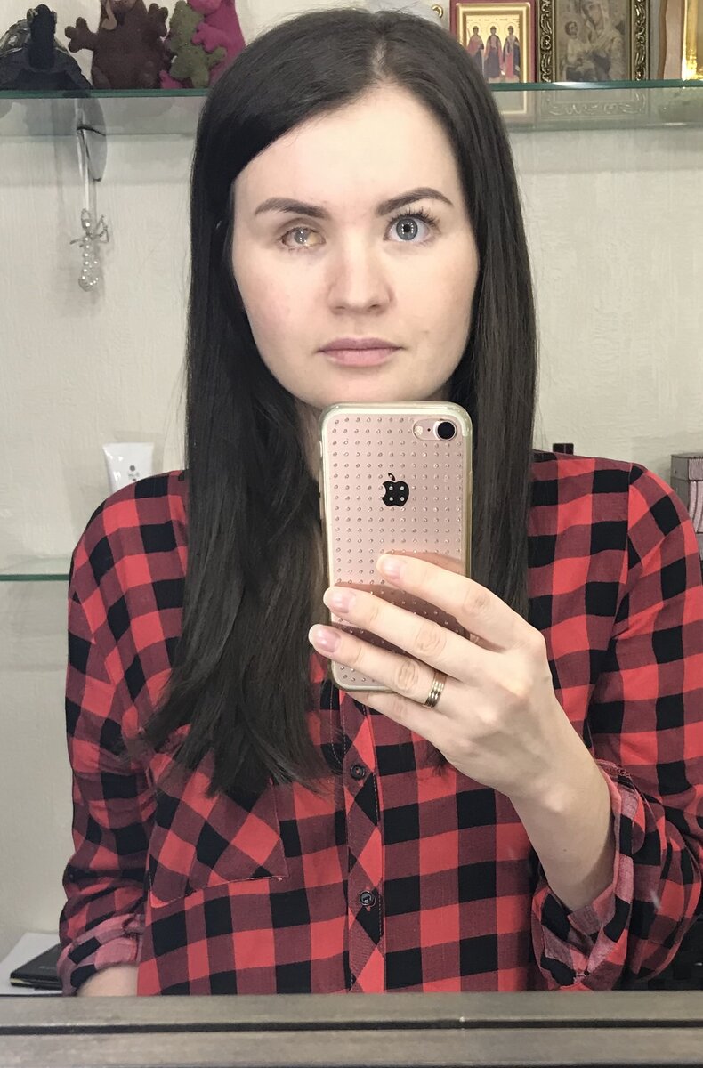 Это фото до удаления глаза и после 11 операций