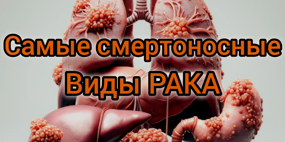 Три самых смертоносных вида рака: факты и статистика!