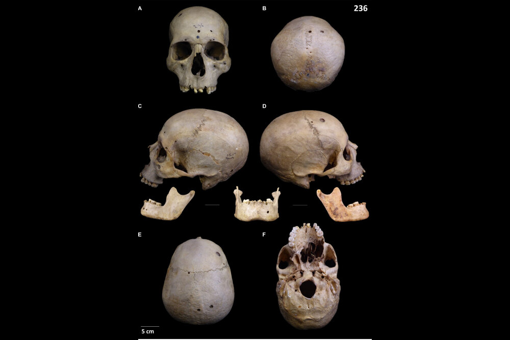     Фото: Tondini et al., Front. Med., 2024