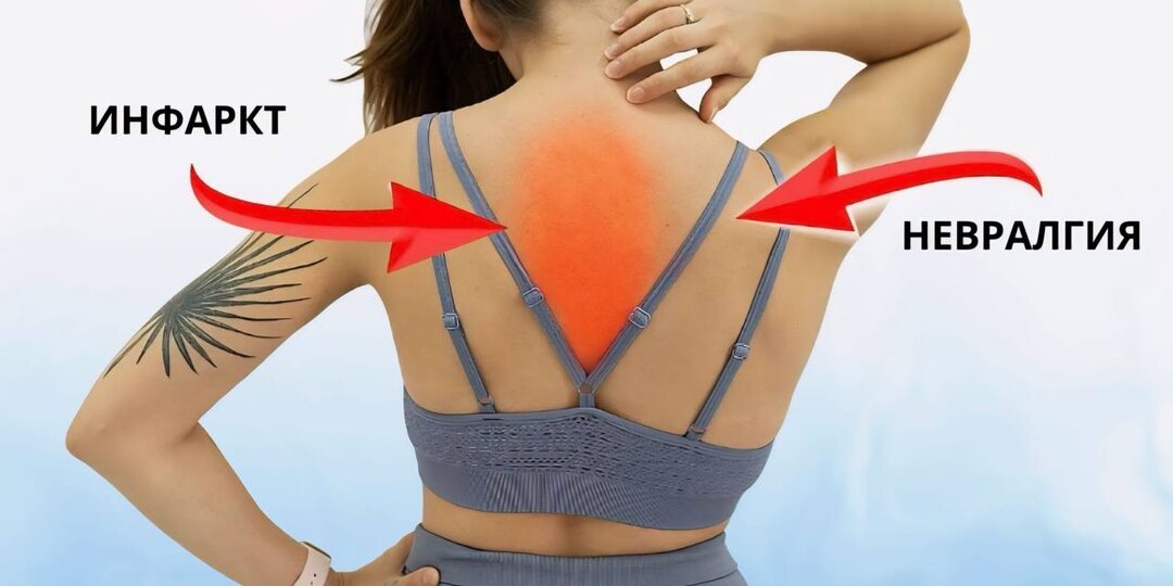 Причины боли под лопатками: инфаркт или проблемы с мышцами? Разбираемся в симптомах