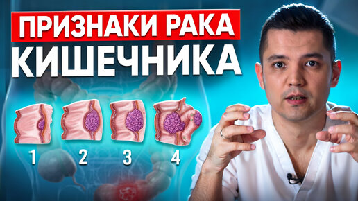 Рак кишечника - как распознать, первые признаки, диагностика.