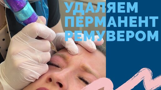 💈Удаление перманента ремувером.