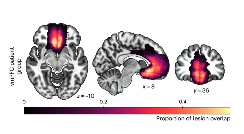   Patricia Lockwood et al. / Nature Human Behaviour, 2024