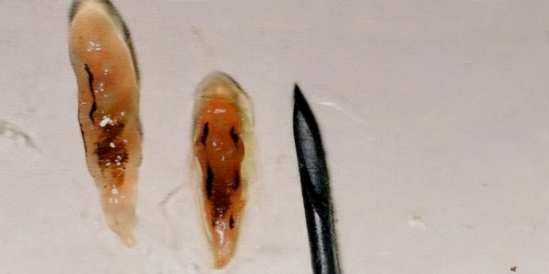 Паразиты Вызывающие Опухоли