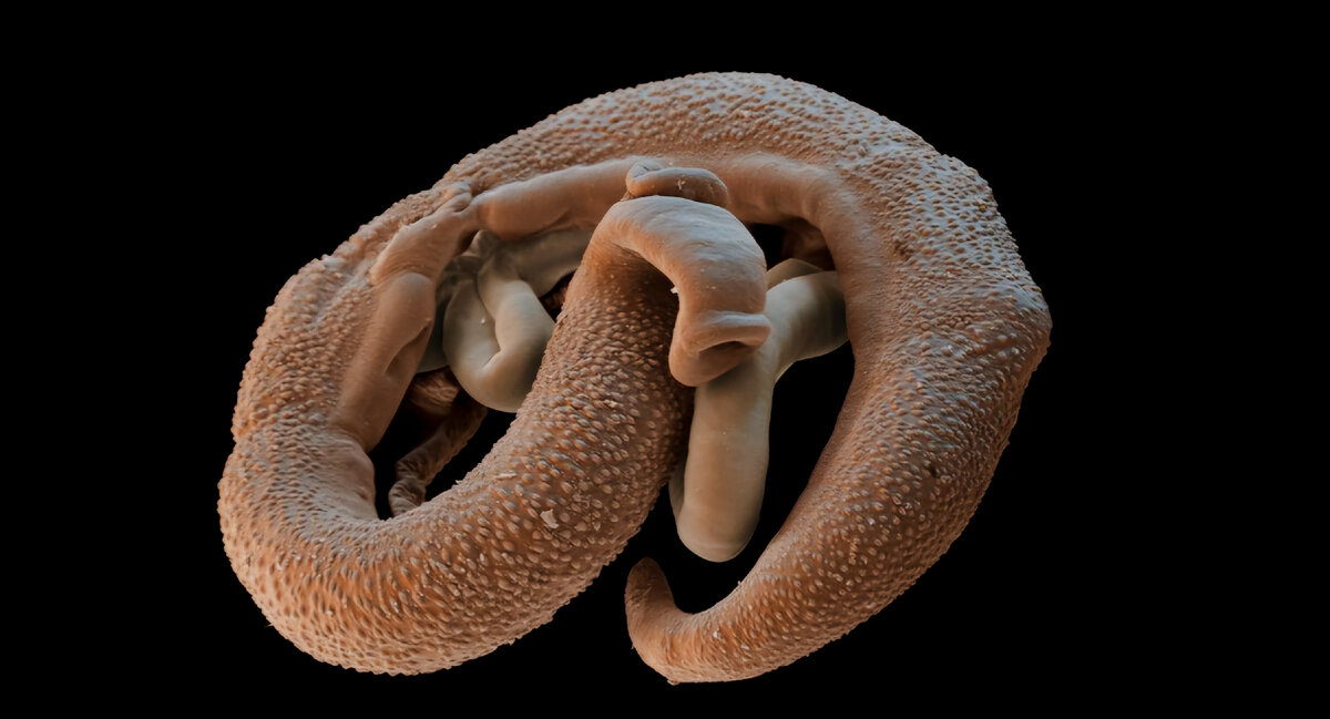 Шистосомы под микроскопом