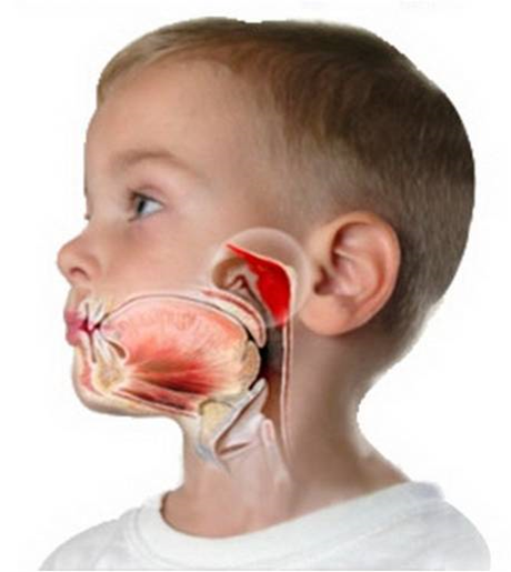 Глоточная миндалина - 1 из многих в организме. Основная ее роль в детском возрасте. С возрастом она уменьшается, затем полностью исчезает.  