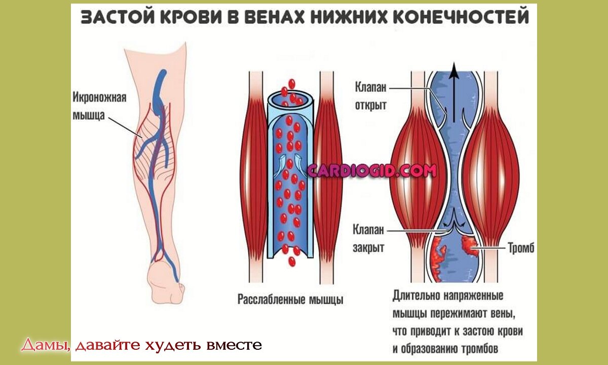 Как должны выглядеть вены