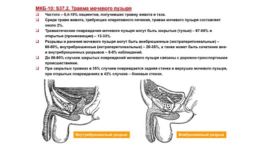 Ультразвуковая диагностика (УЗИ). Доктор Иогансен. Травматические повреждения мочевого пузыря.