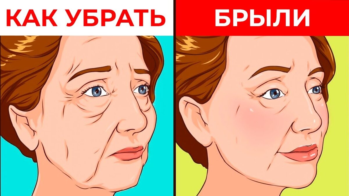 Что такое брыли на лице, причины появления и эффективные методы избавления.