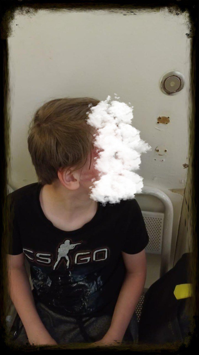 Пострадавший мальчик. Листайте вправо