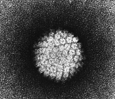 Фото: ru.m.wikipedia.org