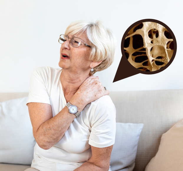 Остеопорозом болеет каждая третья женщина старше 55 лет.