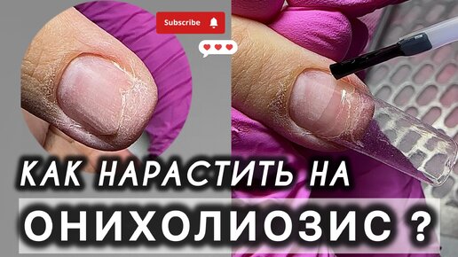 ОНИХОЛИЗИС. КАК НАРАСТИТЬ НОГТИ? ДИП СИСТЕМА