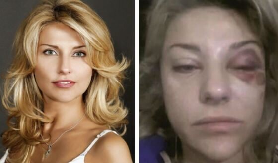    Марат Башаров избивал жену Екатерину Архарову