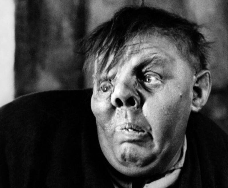 В фильме "Горбун из Нотр-Дама" (1939) Чарльз Лафтон блестяще исполнил роль горбуноватого персонажа. Это не настоящий фрик, над гримом здесь поработал лучший специалист Голливуда 1930-х Перк Уэстмор.