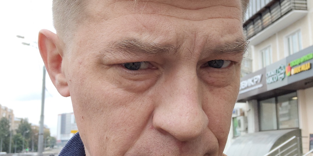 Хронический тонзиллит. Лучше отказаться удалять миндалины.