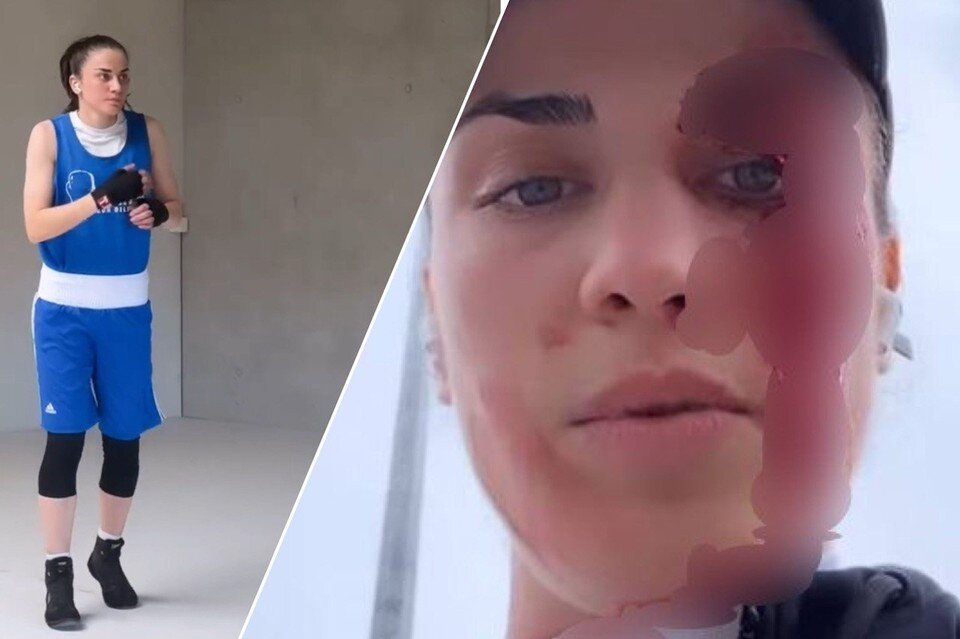    Чеченская спортсменка регулярно получает угрозы за то, что она занимается спортом и выступает в шортах. Фото: соцсети Аминат Эльбукаевой