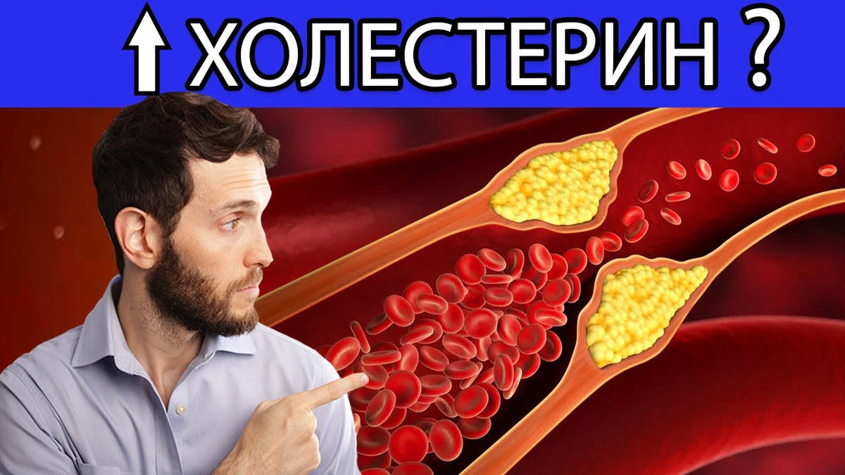 Какие продукты снижают холестерин?