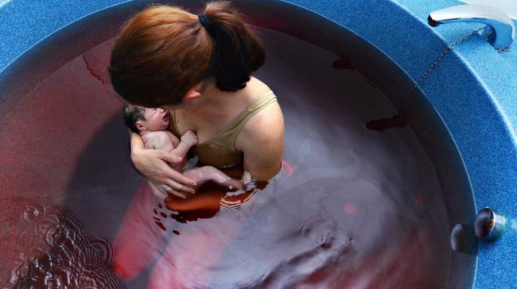 Роды в воде / © Getty Images / Автор: Екатерина Лебедева