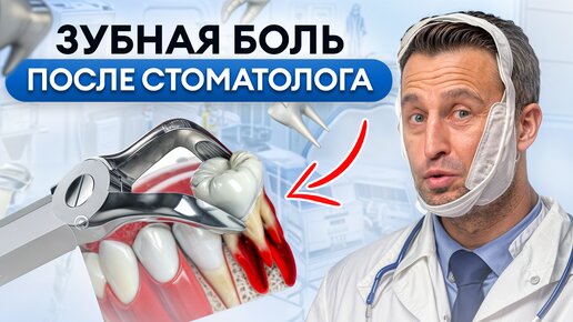 ПОЧЕМУ БОЛЯТ ЗУБЫ после лечения? Как избавиться от ЗУБНОЙ БОЛИ?