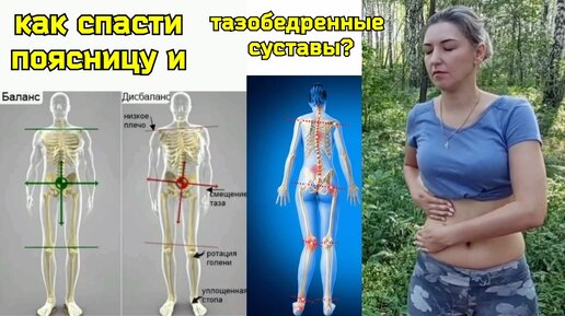 Перекос таза губит поясницу и тазобедренные суставы. Упражнение 