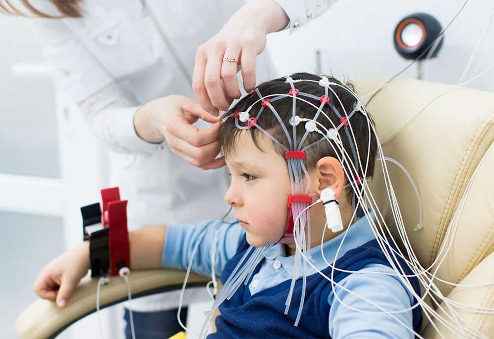 Так проходит процедура ЭЭГ