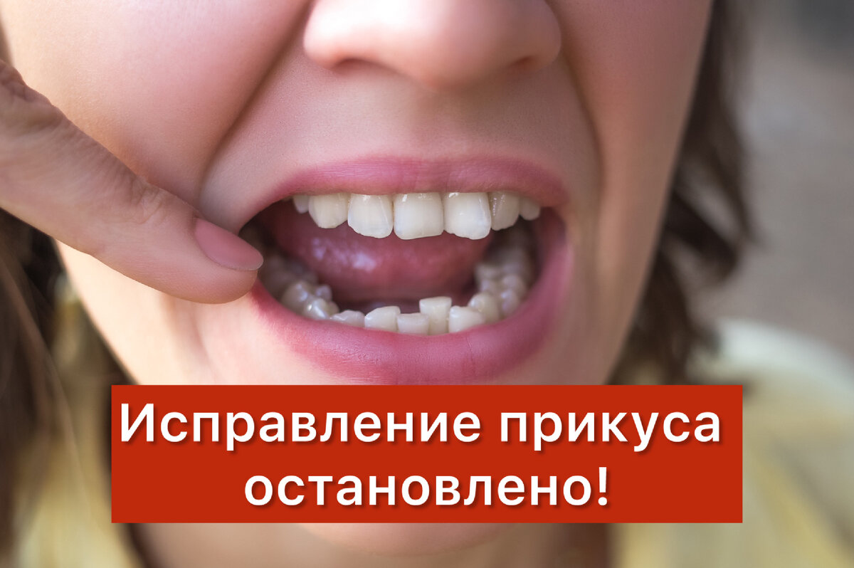 Исправить зубы