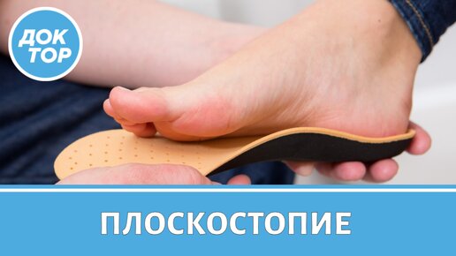 Как вылечить плоскостопие