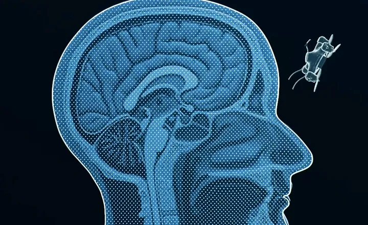 Кадр из короткометражного фильма «Slaughterbots» изображает автономный дрон, нацеленный на человеческий череп. 