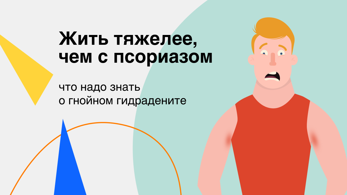 Жить тяжелее, чем с псориазом: что надо знать о гнойном гидрадените |  Здоровый подход | Современная медицина | Дзен