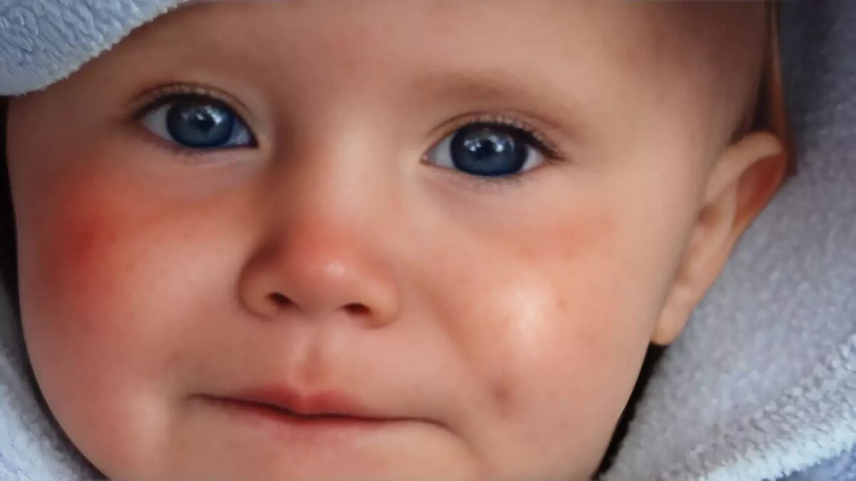     Источник: «Целитель»