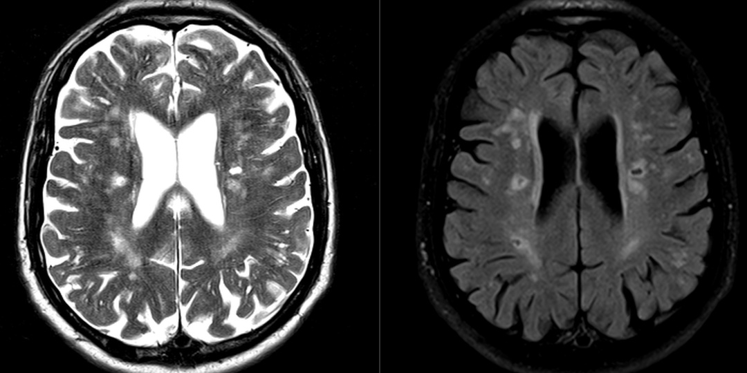 Как люди губят свой мозг (и себя)
