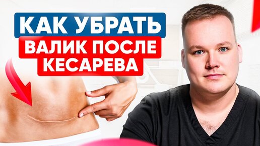 Descargar video: Самая СТРАШНАЯ ОШИБКА! Как восстановиться после кесарева?