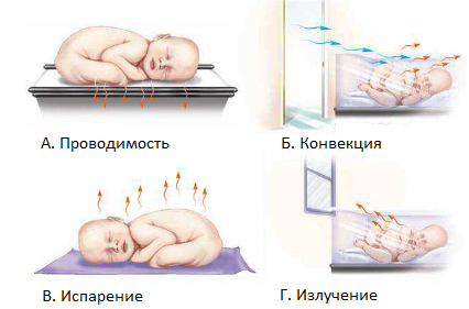 Рис. 2. Пути отдачи тепла новорожденным в окружающую среду