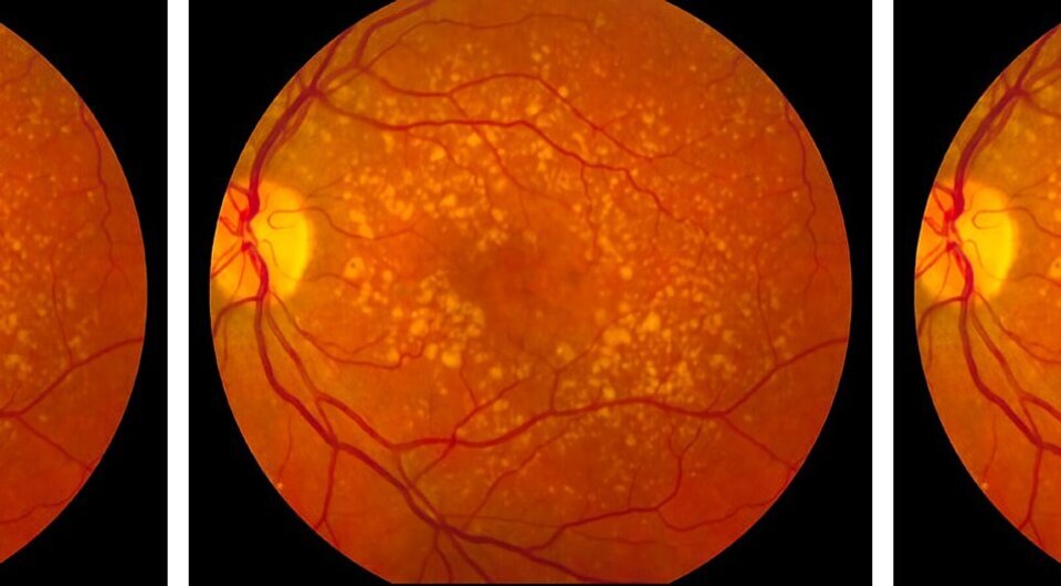   National Institutes of Health / Wikimedia Commons / Public Domain
