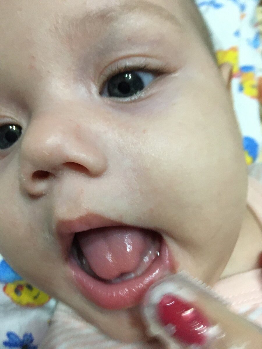 Два первых зубишки.