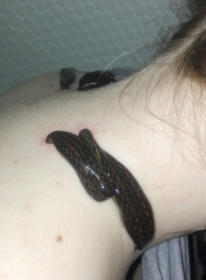 Те самые пиявочки 