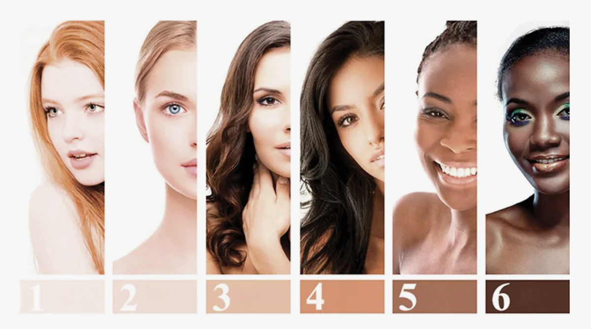 6 фототипов по Фицпатрику