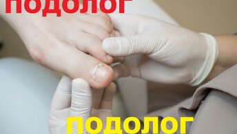 Большие ногти растут настолько глубоко, что вызывают воспаление #подолог #ноготь #онихогрифоз #9