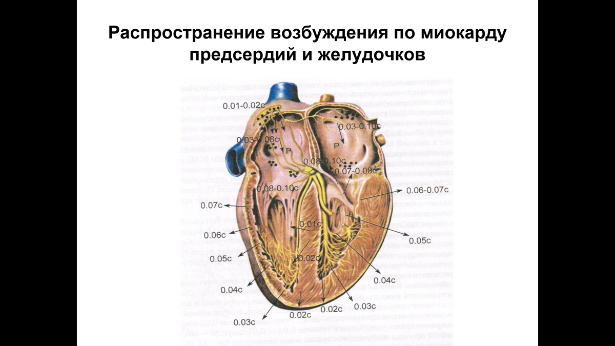 Здесь показано, к какому моменту времени какой отдел желудочков охватывается электрическим импульсом. Соответственно, какой отдел раньше будет охвачен возбуждением - такой и раньше начнет сокращаться. Видно, что раньше всего (первые 0,01 сек) процесс охватывает перегородку. Чуть позже - 0,02-0,03 сек - верхушку сердца (она внизу). Потом, через 0,05-0,06 сек - свободную стенку желудочков. И уже в конце - верхние отделы желудочков (),07 сек). Если стимулирующий электрод будет в правом желудочке - нарушится вся описанная последовательность, и насосная функция сердца может пострадать. 